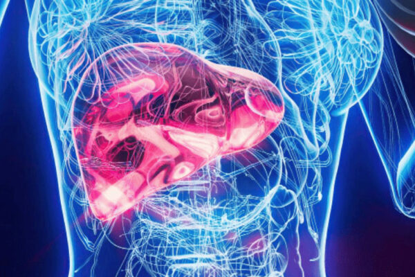 Liver Cancer Liver Cancer