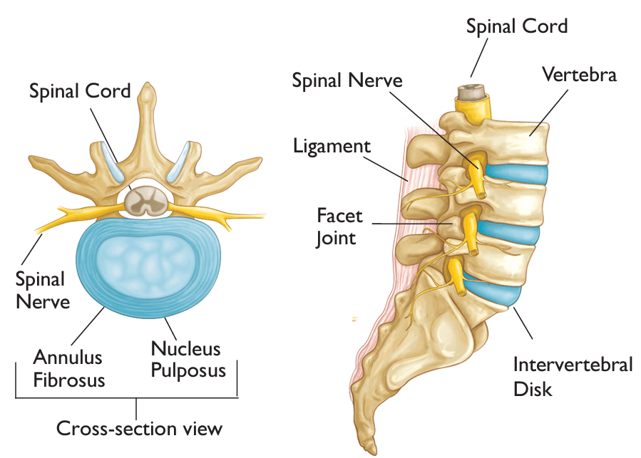 Image of slipped disc