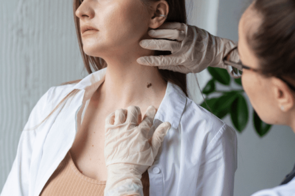 a-women-getting-skin-cancer-screening