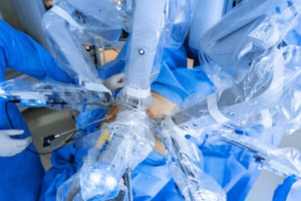 robotic-surgery-for-gerd-featured-image