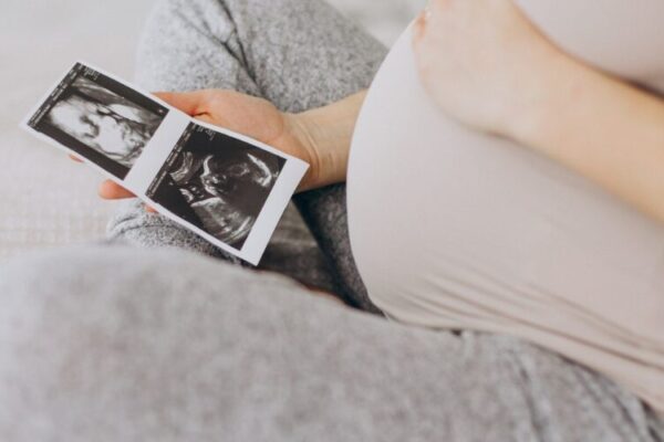 PCOS 1