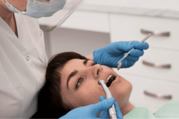 Root Canal