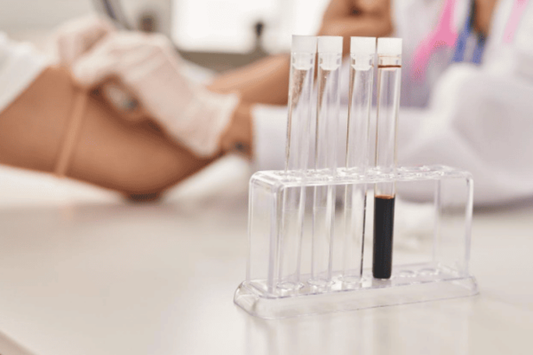 tubes-in-the-lab-genetic-carrier-screening