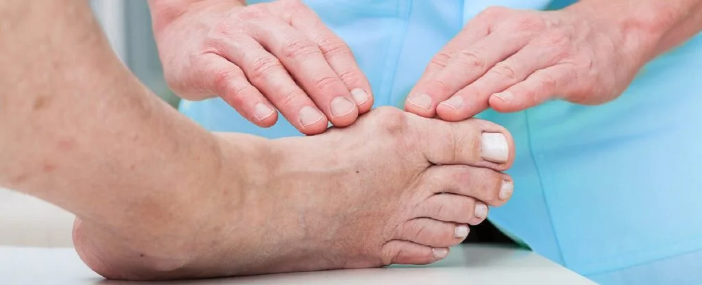 bunion-surgery
