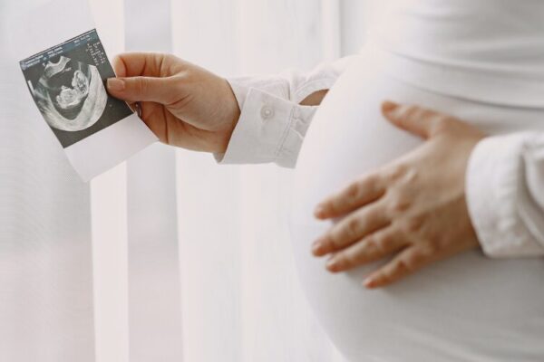 pregnant women holding ultrasound scan image