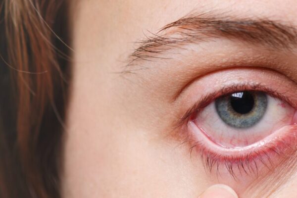 female-show-her-red-eye-close-up female-show-her-red-eye-close-up