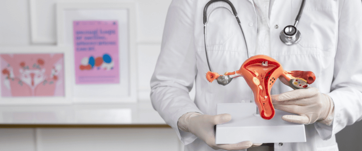 PCOS Treatments Your Gynecologist Recommends.