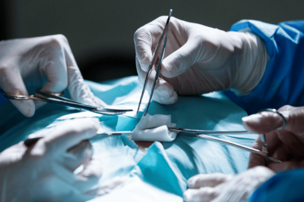 Laparoscopic Surgery featured image