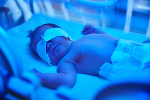 new born jaundice phototheraphy